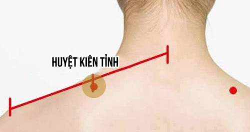 Vị trí huyệt Kiên Tỉnh