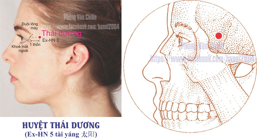 Vị trí huyệt Thái Dương